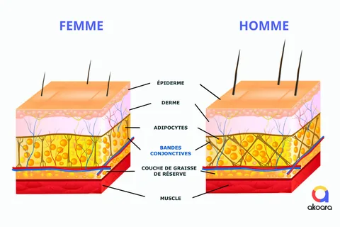 Différence des bandes conjonctives entre hommes et femmes à l'origine de la cellulite