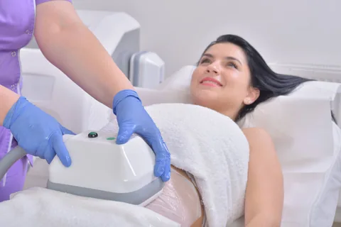 Jeune femme réalisant un traitement par cryolipolyse contre la cellulite du ventre