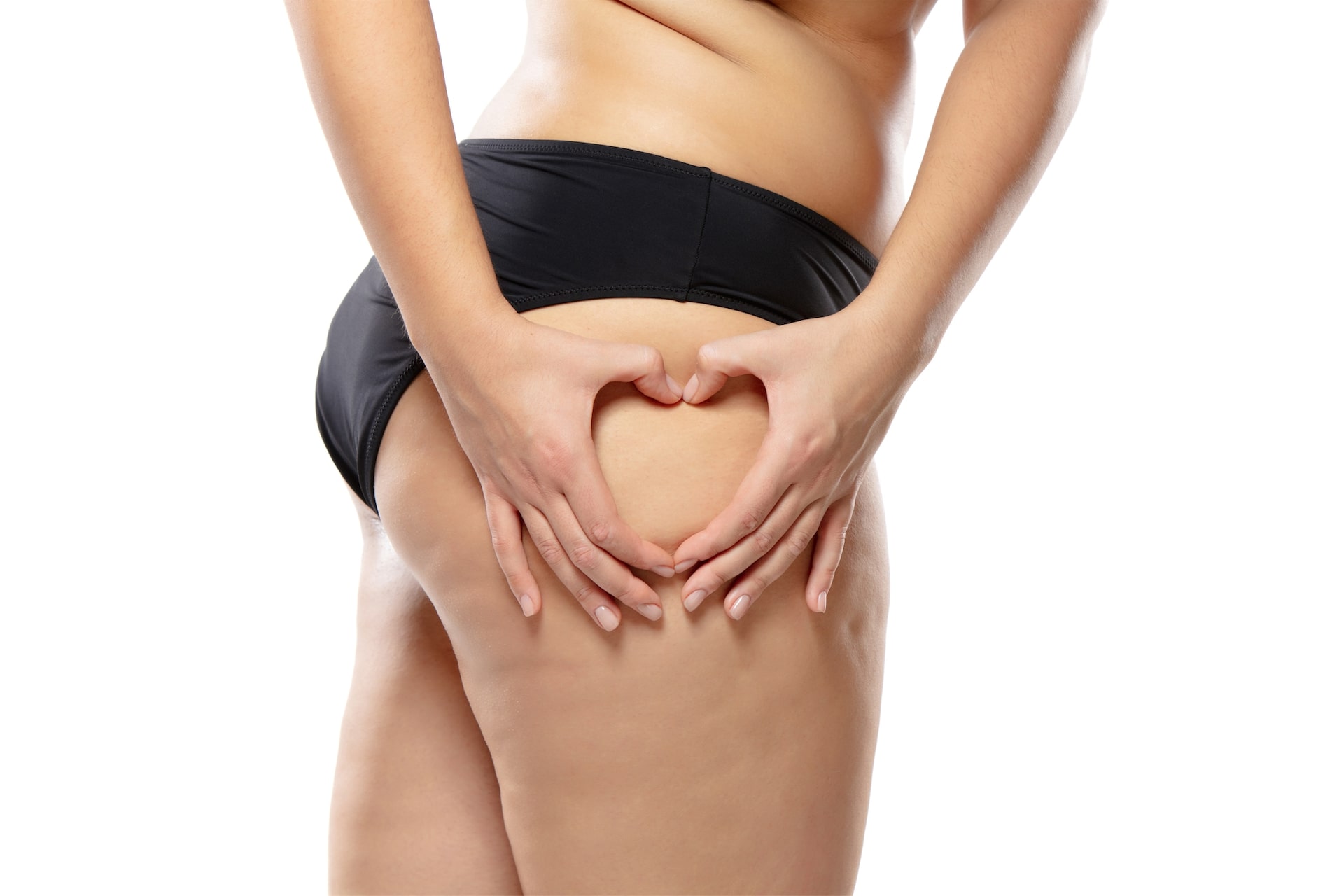 Cellulite sur la jambe d'une jeune femme